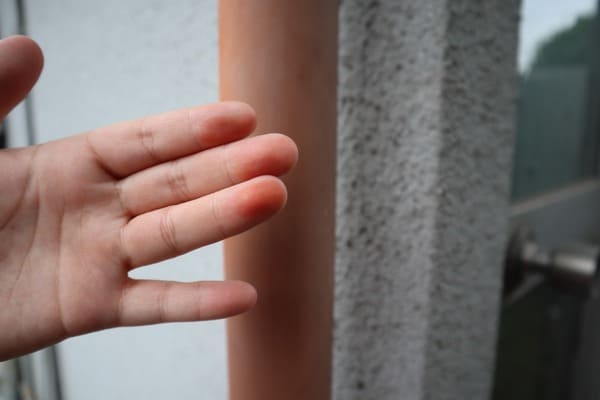 広島県福山市_現地調査_チョーキング